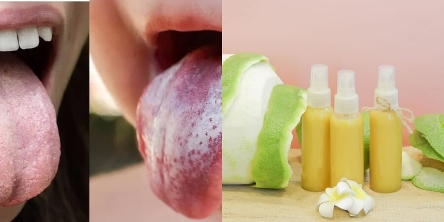 Tinh dầu bưởi dùng để làm gì ức chê nấm Candida