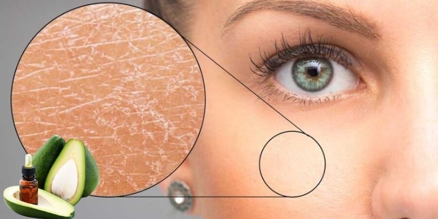 Tinh dầu bơ làm đẹp chăm sóc da khô dễ bong tróc