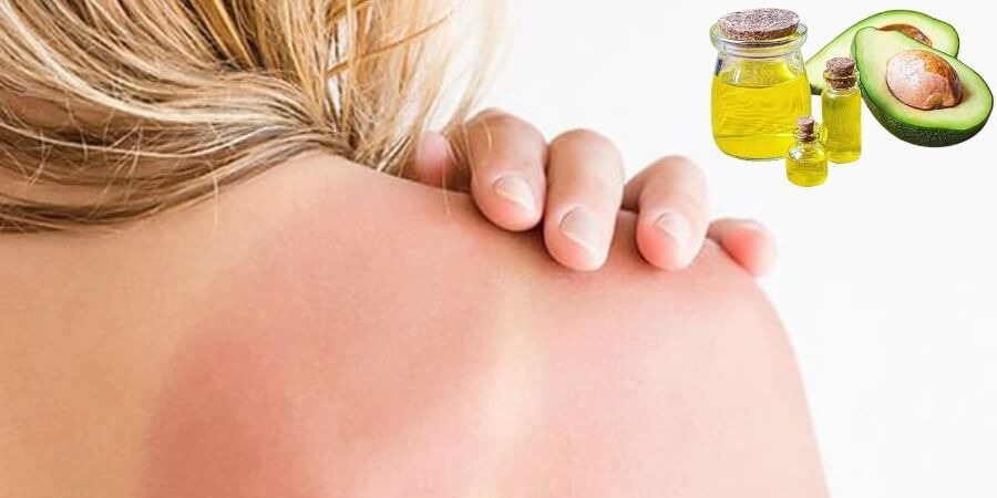 Tinh dầu bơ làm đẹp chăm sóc da sau khi tiếp xúc ánh mặt trời